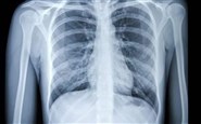 اصول CT قفسه سینه
